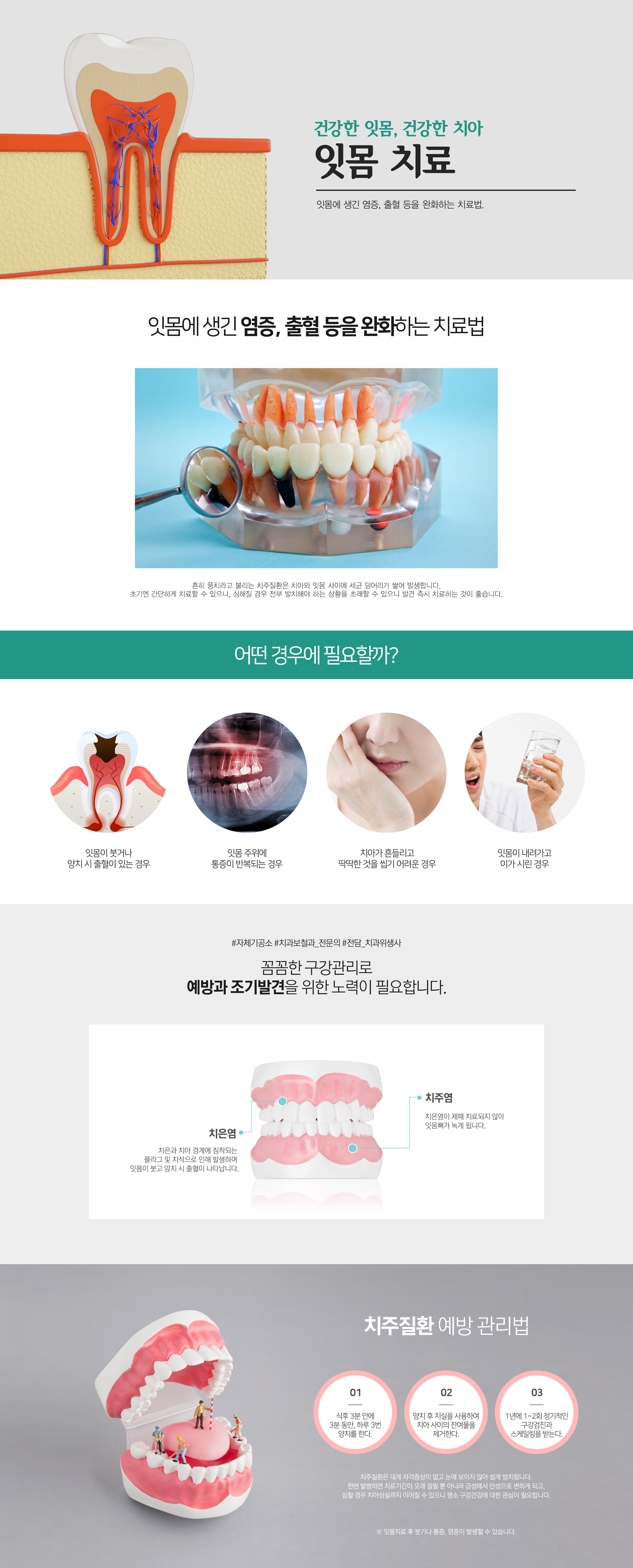 잇몸치료 잇몸치료