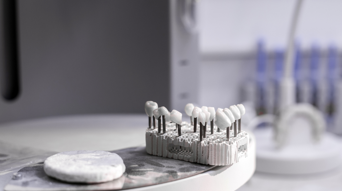 라이브 임플란트