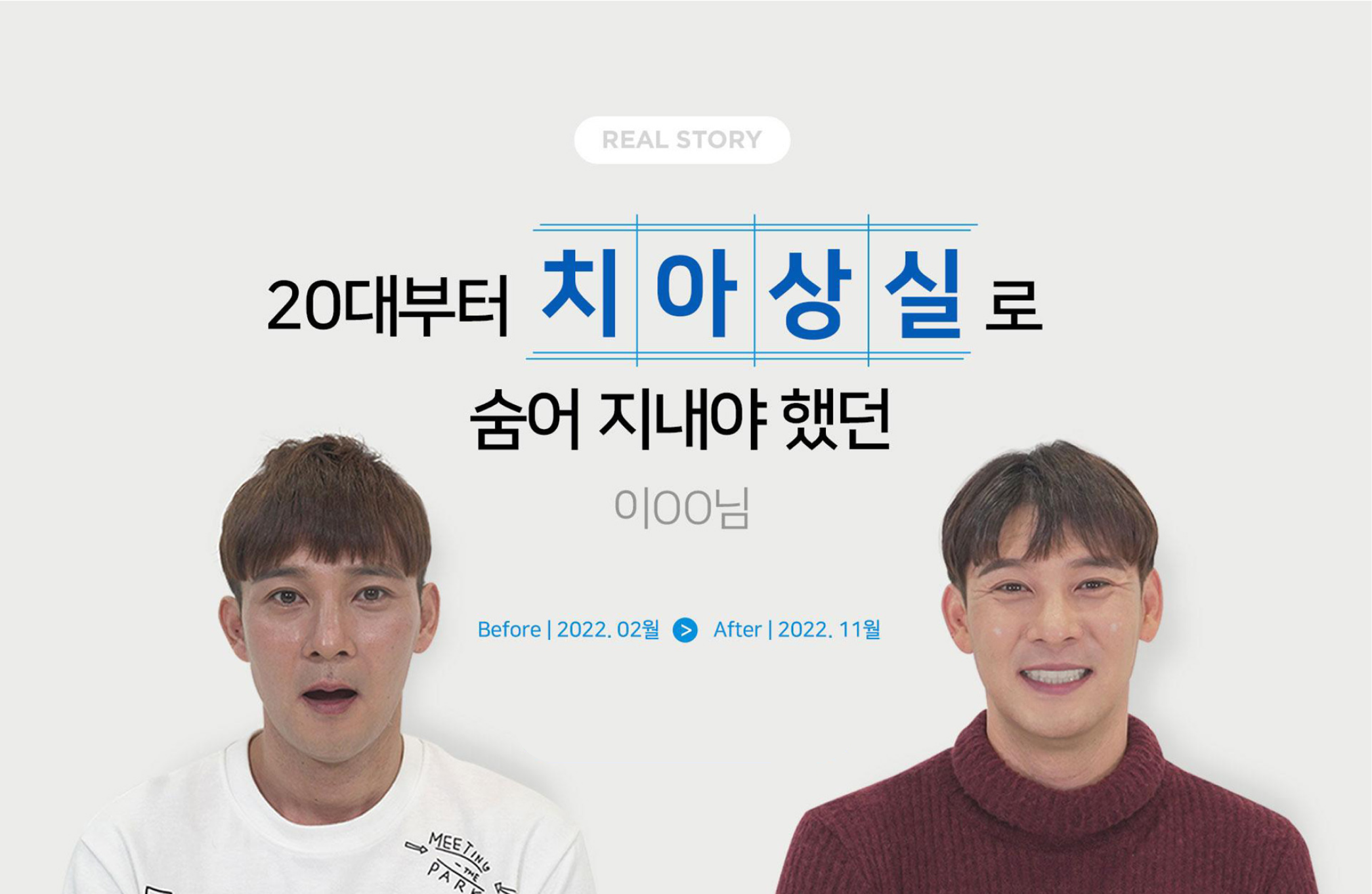 [리얼스토리] 이OO님