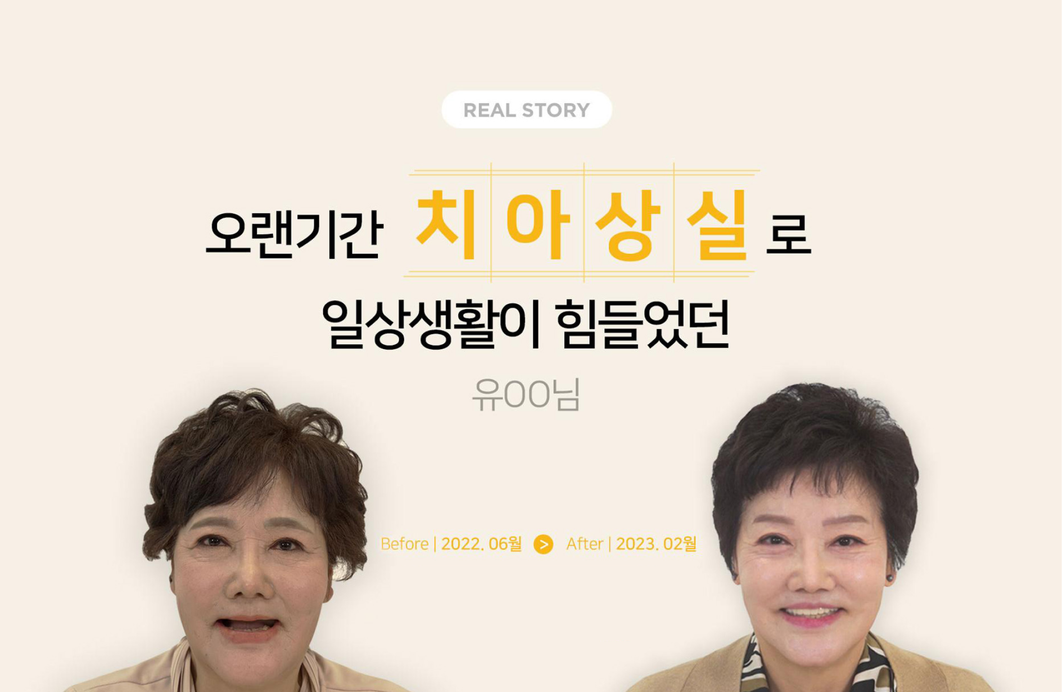 [리얼스토리] 유OO님