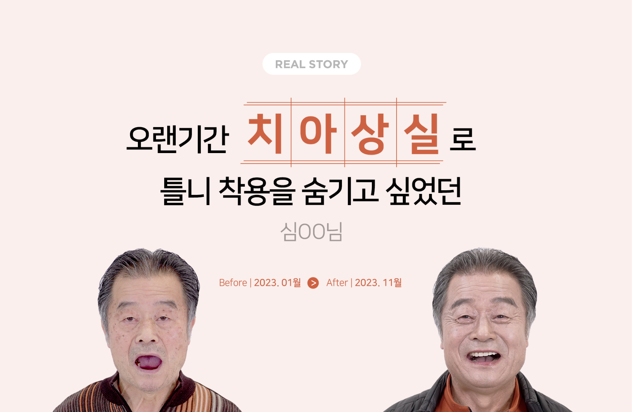 [리얼스토리] 심OO님