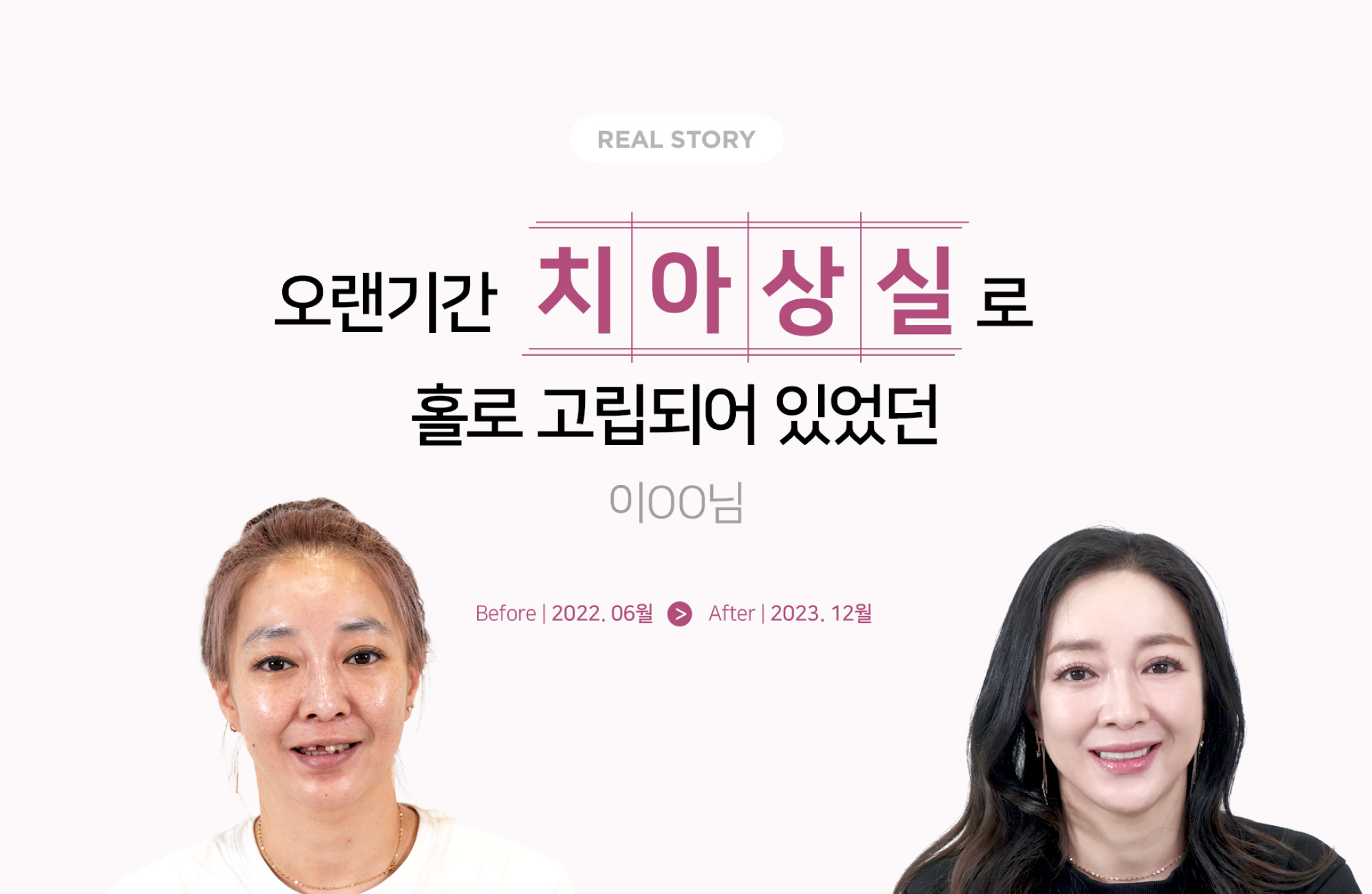 [리얼스토리] 이OO님